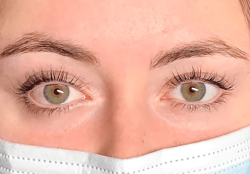 Dieselbe Augenpartie nach dem Wimpernlifting: Wimpern deutlich nach oben geschwungen