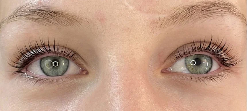 Dieselbe Augenpartie nach dem Wimpernlifting: gebogene, dunklere Wimpern