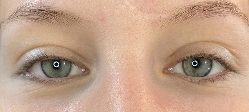 Augenpartie vor dem Wimpernlifting: flache, helle Wimpern